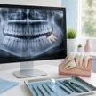 21d6814f-67e1-4a93-b26e-ebea811b45fb-08-complex-impacted-wisdom-tooth-extraction.jpg