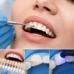 5cde98f9-fb1f-44fa-92eb-35370a3ff0ad-32-aesthetic-nanocomposite-restoration.jpg